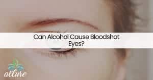 Can Alcohol Cause Bloodshot Eyes?