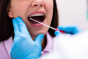 mouth swab