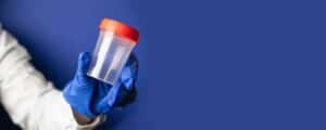 urine test
