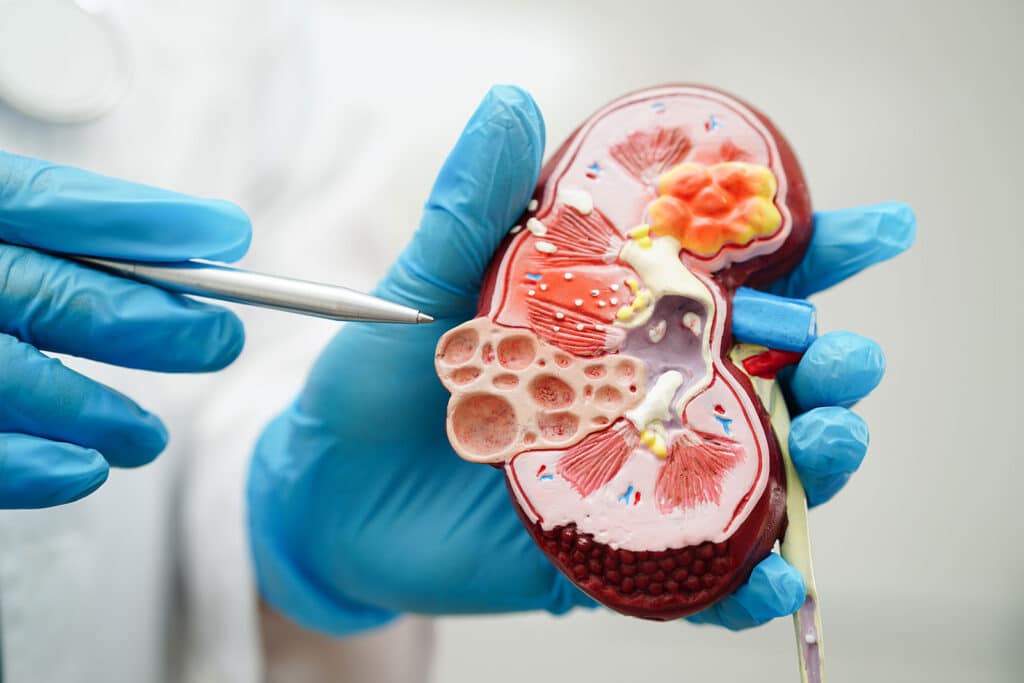 kidney